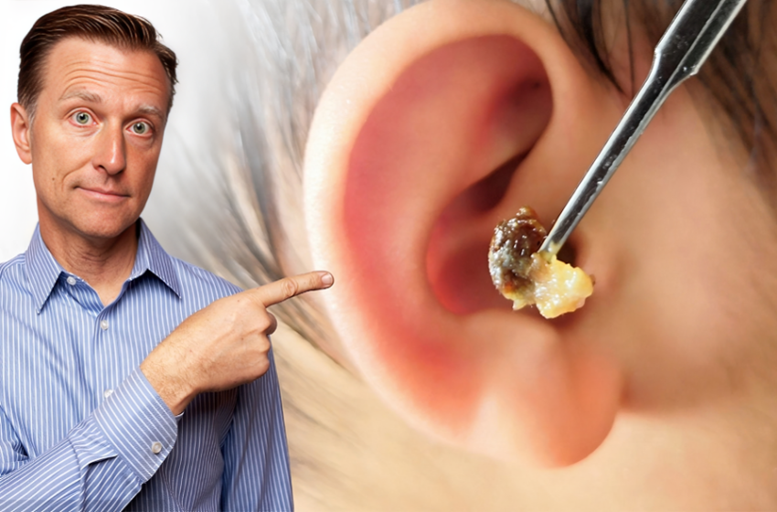  Earwax Buildup.. Causes, Symptoms, and Effective Treatments